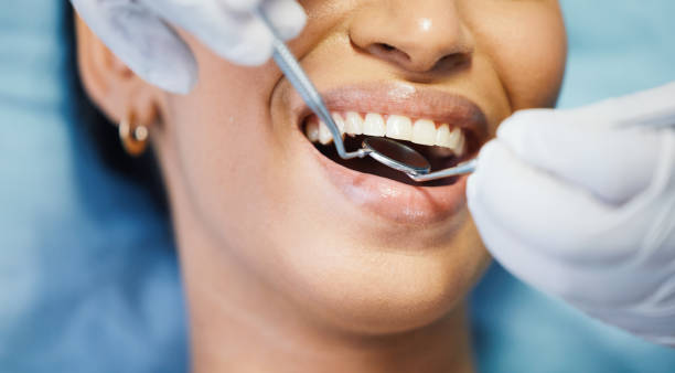 Best Emergency Dental Surgery in Yorktown, TX